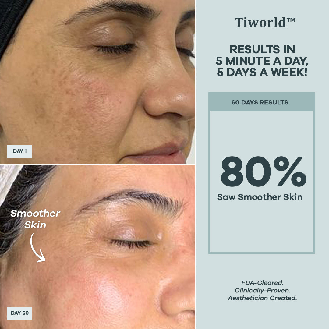 Tiworld™ Micro-Needling Infusion System